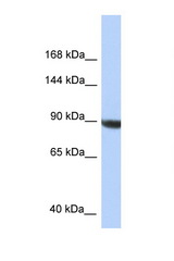 KIAA1549 antibody LS-C145773 Western blot of HepG2 Cell lysate. Antibody concentration 1 ug/ml.