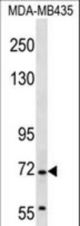 GRHL2 Antibody western blot of MDA-MB435 cell line lysates (35 ug/lane). The GRHL2 antibody detected the GRHL2 protein (arrow).