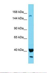 Western blot of Human MCF9. KIAA1683 antibody dilution 1.0 ug/ml.