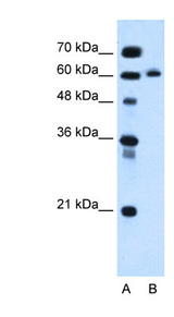 ITPRIPL1 / KIAA1754L antibody LS-C40485 Western blot of HepG2 cell lysate.