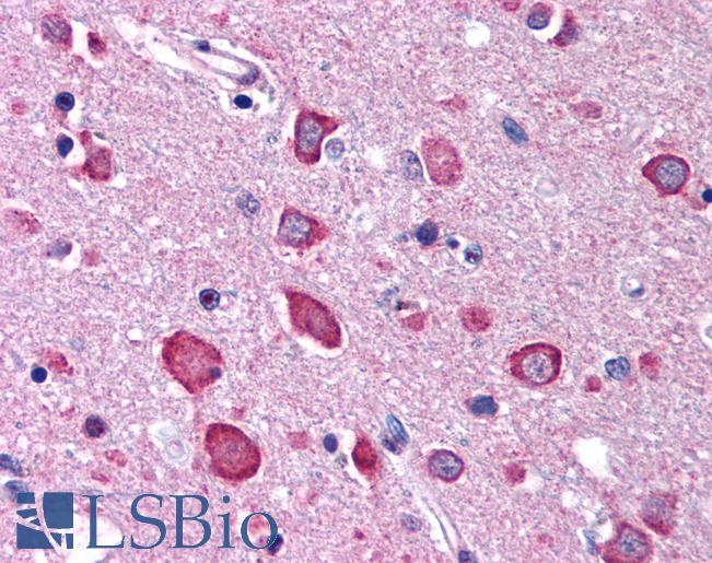 Anti-BRSK1 antibody IHC of human brain, cortex. Immunohistochemistry of formalin-fixed, paraffin-embedded tissue after heat-induced antigen retrieval. Antibody LS-B180 concentration 5 ug/ml.