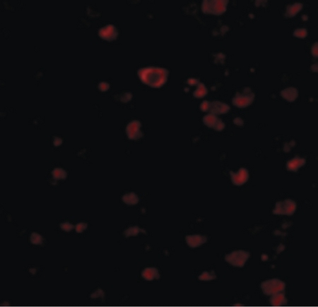 Immunofluorescence of BRSK1 in Human Brain cells with BRSK1 antibody at 20 ug/ml.