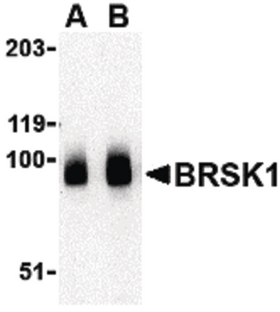 Western blot of BRSK1 in human brain tissue lysate with BRSK1 antibody at (A) 0.5 and (B) 1 ug/ml.