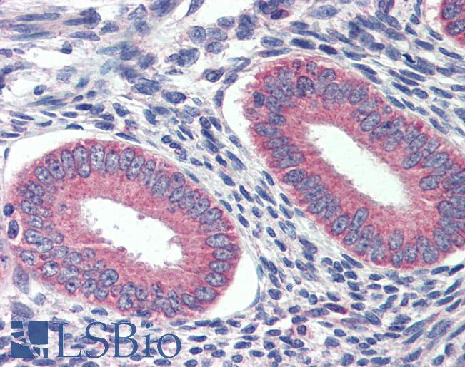 Anti-GRHL2 antibody IHC of human prostate. Immunohistochemistry of formalin-fixed, paraffin-embedded tissue after heat-induced antigen retrieval. Antibody LS-B3983 concentration 5 ug/ml.