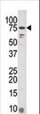 Western blot of anti-KIAA181 antibody in mouse liver tissue lysate (35 ug/lane). KIAA181(arrow) was detected using the purified antibody.