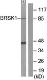 Western blot of extracts from 293 cells, using BRSK1 Antibody. The lane on the right is treated with the synthesized peptide.