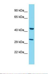 Western blot of Human A549. MSANTD4 antibody dilution 1.0 ug/ml.