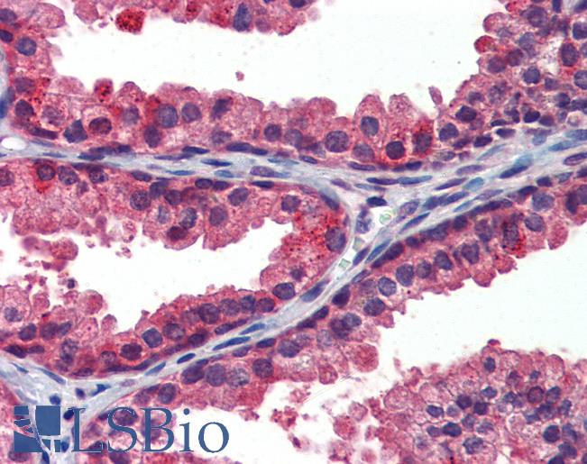 Anti-SPG11 antibody IHC of human prostate. Immunohistochemistry of formalin-fixed, paraffin-embedded tissue after heat-induced antigen retrieval. Antibody LS-B3872 concentration 5 ug/ml.