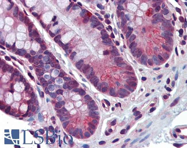 Anti-SPG11 antibody IHC of human small intestine. Immunohistochemistry of formalin-fixed, paraffin-embedded tissue after heat-induced antigen retrieval. Antibody LS-B3872 concentration 5 ug/ml.