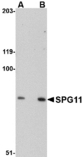 Western blot of SPG11 in mouse heart tissue lysate with SPG11 antibody at (A) 0.5 and (B) 1 ug/ml.