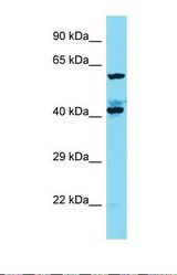 Western blot of Human A549. KIAA1841 antibody dilution 1.0 ug/ml.