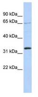 Western blot of 721_B cell lysate.