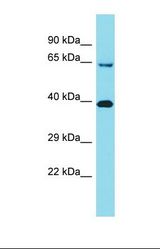 Western blot of Human Placenta. KIAA2013 antibody dilution 1.0 ug/ml.