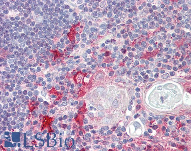 Anti-KIF13B / GAKIN antibody IHC of human thymus. Immunohistochemistry of formalin-fixed, paraffin-embedded tissue after heat-induced antigen retrieval. Antibody LS-B8565 dilution 5 ug/ml.