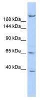 Western blot of HepG2 cell lysate.