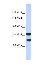 Western blot of Human 293T. KIF16B antibody dilution 1.0 ug/ml.
