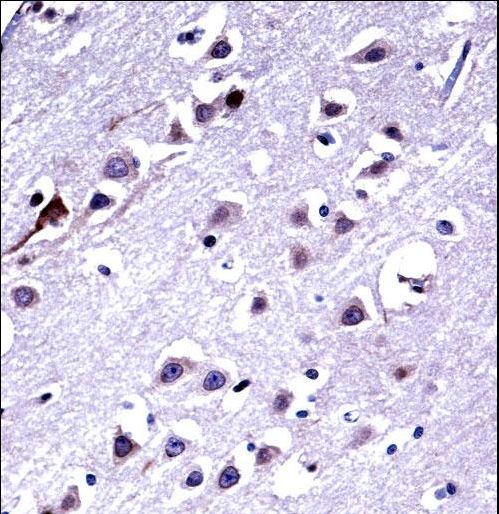 KIF16b Antibody immunohistochemistry of formalin-fixed and paraffin-embedded human brain tissue followed by peroxidase-conjugated secondary antibody and DAB staining.