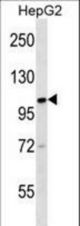 KIF18A Antibody western blot of HepG2 cell line lysates (35 ug/lane). The KIF18A antibody detected the KIF18A protein (arrow).