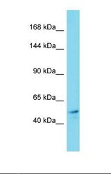 Western blot of Human Thyroid Tumor. KIF19 antibody dilution 1.0 ug/ml.