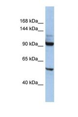 Western blot of Human HepG2. KIF19 antibody dilution 1.0 ug/ml.