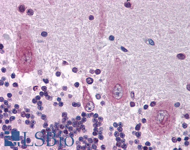 Anti-KIF21A antibody IHC of human brain, cerebellum. Immunohistochemistry of formalin-fixed, paraffin-embedded tissue after heat-induced antigen retrieval. Antibody LS-B1542 concentration 5 ug/ml.