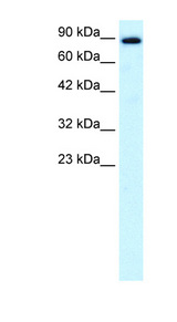 KIF21A antibody LS-B1542 Western blot of Fetal Brain lysate.