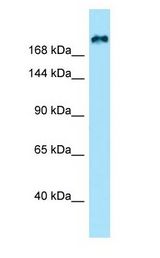 KIF21B antibody Western Blot of HeLa.