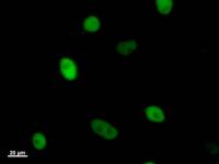 Immunostaining analysis in HeLa cells. HeLa cells were fixed with 4% paraformaldehyde and permeabilized with 0.1% Triton X-100 in PBS. The cells were immunostained with anti-KIF22 mAb.