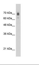 Jurkat Cell Lysate