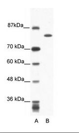 A: Marker, B: Jurkat Cell Lysate