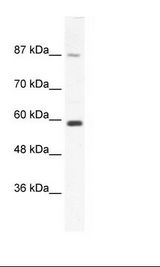 Jurkat Cell Lysate
