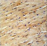 KIF24 Antibody immunohistochemistry of formalin-fixed and paraffin-embedded mouse heart tissue followed by peroxidase-conjugated secondary antibody and DAB staining.