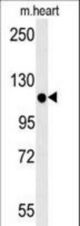 KIF24 Antibody western blot of mouse heart tissue lysates (15 ug/lane). The KIF24 antibody detected KIF24 protein (arrow).