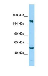 Western blot of Human MDA-MB-435S. KIF24 antibody dilution 1.0 ug/ml.