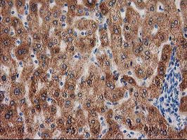 IHC of paraffin-embedded Human liver tissue using anti-GRHPR mouse monoclonal antibody. (Heat-induced epitope retrieval by 10mM citric buffer, pH6.0, 100C for 10min).