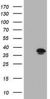 HEK293T cells were transfected with the pCMV6-ENTRY control (Left lane) or pCMV6-ENTRY KIF25 (Right lane) cDNA for 48 hrs and lysed. Equivalent amounts of cell lysates (5 ug per lane) were separated by SDS-PAGE and immunoblotted with anti-KIF25.