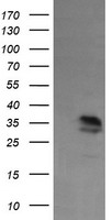 HEK293T cells were transfected with the pCMV6-ENTRY control (Left lane) or pCMV6-ENTRY KIF25 (Right lane) cDNA for 48 hrs and lysed. Equivalent amounts of cell lysates (5 ug per lane) were separated by SDS-PAGE and immunoblotted with anti-KIF25.