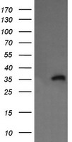 HEK293T cells were transfected with the pCMV6-ENTRY control (Left lane) or pCMV6-ENTRY KIF25 (Right lane) cDNA for 48 hrs and lysed. Equivalent amounts of cell lysates (5 ug per lane) were separated by SDS-PAGE and immunoblotted with anti-KIF25.
