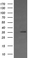 HEK293T cells were transfected with the pCMV6-ENTRY control (Left lane) or pCMV6-ENTRY KIF25 (Right lane) cDNA for 48 hrs and lysed. Equivalent amounts of cell lysates (5 ug per lane) were separated by SDS-PAGE and immunoblotted with anti-KIF25.