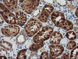 IHC of paraffin-embedded Human Kidney tissue using anti-GRHPR mouse monoclonal antibody. (Heat-induced epitope retrieval by 10mM citric buffer, pH6.0, 100C for 10min).