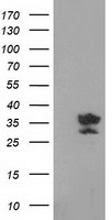 HEK293T cells were transfected with the pCMV6-ENTRY control (Left lane) or pCMV6-ENTRY GRHPR (Right lane) cDNA for 48 hrs and lysed. Equivalent amounts of cell lysates (5 ug per lane) were separated by SDS-PAGE and immunoblotted with anti-GRHPR.