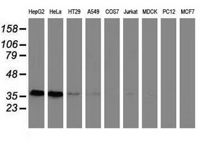 Western blot of extracts (35ug) from 9 different cell lines by using anti-GRHPR monoclonal antibody.