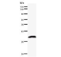 Western blot analysis of immunized recombinant protein, using anti-KIF2C monoclonal antibody.
