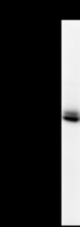 Detection of human KIF2C by Western blot. Samples: Whole cell lysate (25 ug) from HeLa cells. Predicted molecular weight: 81 kDa