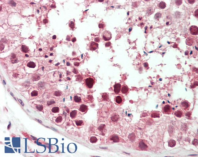 Anti-KIF2C / MCAK antibody IHC staining of human testis. Immunohistochemistry of formalin-fixed, paraffin-embedded tissue after heat-induced antigen retrieval. Antibody LS-B11306 concentration 5 ug/ml.