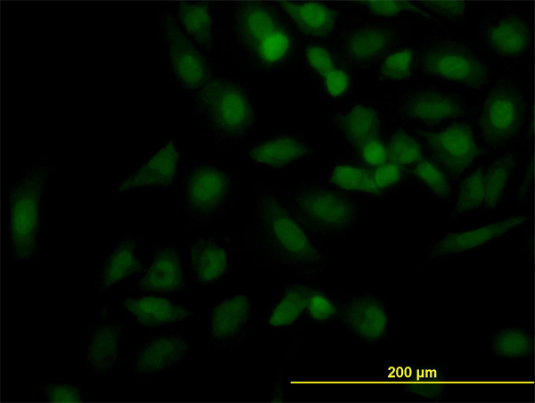 Immunofluorescence of monoclonal antibody to KIF2C on HeLa cell. [antibody concentration 10 ug/ml]