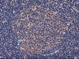 IHC of paraffin-embedded Human lymph node tissue using anti-GRHPR mouse monoclonal antibody. (Heat-induced epitope retrieval by 10mM citric buffer, pH6.0, 100C for 10min).