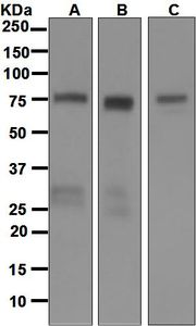 Western blot analysis on (A) fetal brain, (B) human testis, and (C) SH-SY5Y lysates using anti-KIF3A antibody.
