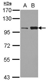Sample (30 ug of whole cell lysate) A: HeLa B: HepG2 7.5% SDS PAGE KIF3C antibody diluted at 1:3000