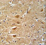 KIF3C Antibody immunohistochemistry of formalin-fixed and paraffin-embedded human brain tissue followed by peroxidase-conjugated secondary antibody and DAB staining.